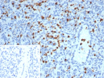 IHC staining of FFPE human spleen tissue with S100 calcium-binding protein A13 antibody (clone S100A