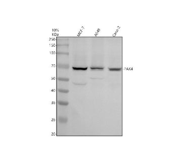 Western blot analysis of PAK4 using anti-PAK4 antibody. Electrophoresis was performed on a 10% SDS-P