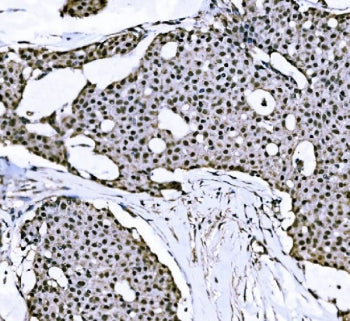 NACC1 Antibody / NAC1 / BTBD14B
