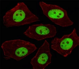 Immunofluorescent analysis of A549 cells using LIN28A antibody at 1:100. Alexa Fluor 488-conjugated 