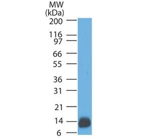 S100B Antibody