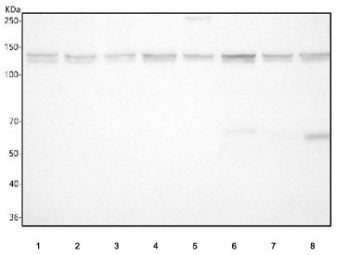 Western blot testing of 1) human HeLa, 2) human SH-SY5Y, 3) human U-2 OS, 4) rat brain, 5) rat C6, 7) mouse brain and 8) mouse Neuro-2a cell lysate with CYFIP1 antibody. Predicted molecular weight ~145 kDa but multiple smaller isoforms.