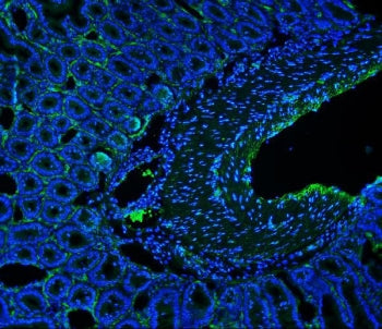 Immunofluorescent staining of FFPE mouse intestine with Cd146 antibody (green) and DAPI nuclear stai