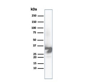 Western blot analysis of human liver tissue lysate using Arginase 1 antibody (clone ARG1/6790R). Pre