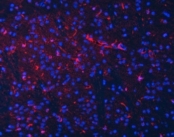 SEPT2 Antibody / Septin 2