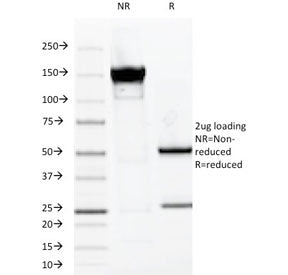 SDS-PAGE Analysis of Purified, BSA-Free MUC-1 Antibody (clone VU-2G7). Confirmation of Integrity and