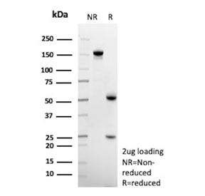 SDS-PAGE Analysis of Purified, BSA-Free Anti-CD14 Antibody (clone LPSR/553). Confirmation of Integri