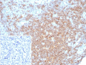 IHC staining of FFPE human lymph node tissue with CD27 antibody (clone LPFS2/8316R). Inset: PBS used
