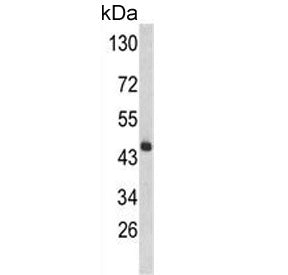 Western blot testing of mouse liver tissue lysate with HPD antibody. Predicted molecular weight ~45 