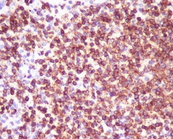 IHC staining of FFPE human spleen tissue with CD45 antibody. HIER: boil tissue sections in pH6, 10mM