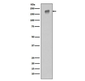 Western blot testing of human HeLa cell lysate with EGFR antibody. Expected molecular weight: 134-17