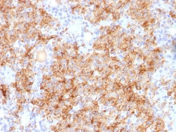 Chromogranin A Antibody