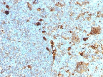 Alpha 1 Antitrypsin Antibody / AAT / SERPINA1