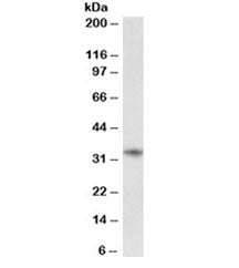 Western blot testing of human tonsil lysate with CD74 antibody. Expected molecular weight: 33-43 kDa