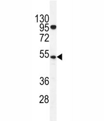 TdT Antibody
