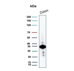 Western blot testing of human colon tissue lysate with Calponin 1 antibody. Predicted molecular weig