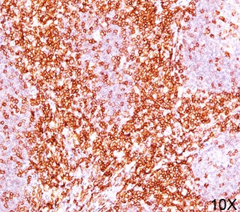CD6 Antibody Cocktail