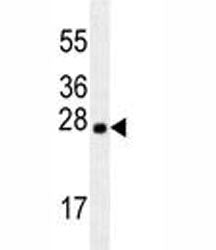 LXN Antibody / Latexin, 0.4ml