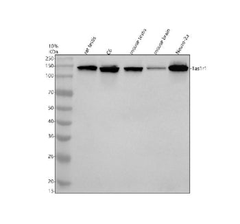 Western blot analysis of TAS1R1 using anti-TAS1R1 antibody. Electrophoresis was performed on a 10% S