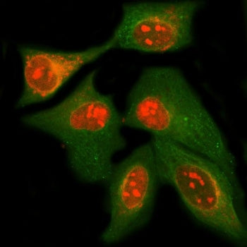 MPHOSPH10 Antibody / M phase phosphoprotein 10