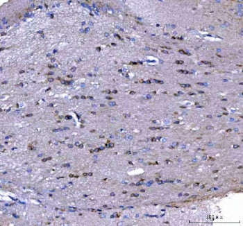 MAP6D1 Antibody / MAP6 domain-containing protein 1