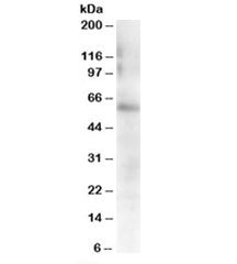Western blot testing of mouse spleen lysate with FGR antibody at 0.5ug/ml. Predicted molecular weigh