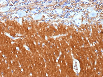 IHC staining of FFPE human brain tissue with Neural cell adhesion molecule L1 antibody (clone L1CAM/