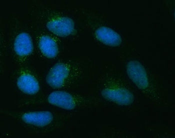 ZNRF3 Antibody / Zinc/RING finger protein 3