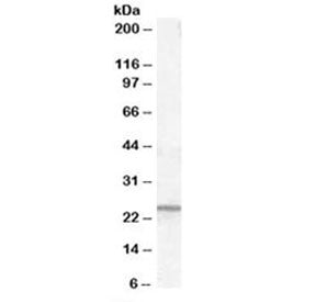 Western blot testing of human kidney lysate with PGRMC1 antibody at 0.1ug/ml. Predicted molecular we