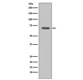 Western blot testing of human K562 cell lysate with Raf1 antibody. Predicted molecular weight ~73 kD