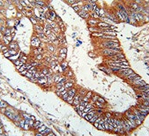 Kelch-like protein 6 Antibody / KLHL6