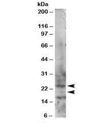 Western blot testing of HeLa lysate with RAB2 antibody at 1ug/ml. Isoforms of 24kDa and 21kDa can be