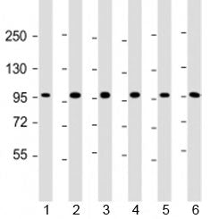 Western blot testing of human 1) HepG2, 2) U-251 MG, 3) A431, 4) HeLa, 5) CCRF-CEM and 6) HL-60 cell