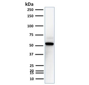 Western blot testing of human A431 cell lysate with TOX3 antibody. Predicted molecular weight ~63 kD