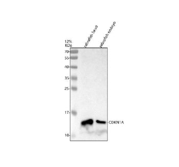 Western blot analysis of Cdkn1a protein using Zebrafish Cdkn1a antibody and 1) zebrafish head tissue