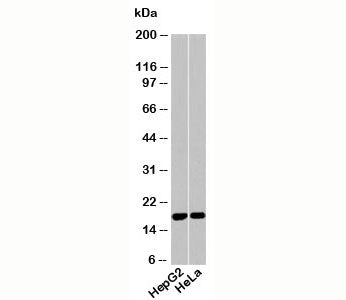Western blot testing of human samples using Acid Phosphatase antibody at 1ug/ml.
