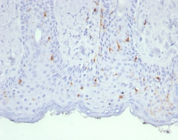 IHC staining of FFPE human skin tissue with Langerin antibody (clone LGRN/7430). HIER: boil tissue s