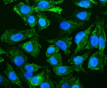 Immunofluorescent staining of FFPE human A549 cells with CAV2 antibody (green) and DAPI nuclear stai