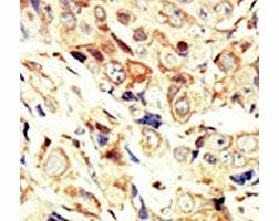 IGF1R Antibody