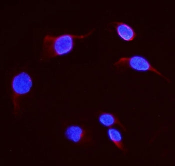 Immunofluorescent staining of FFPE human U-2 OS cells with DHFR antibody (red) and DAPI nuclear stai