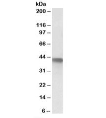 Western blot testing of A549 lysate with SERPINB1 antibody at 1ug/ml. Predicted/observed molecular w