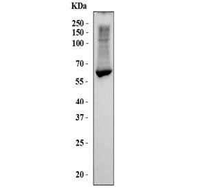 Western blot testing of human HepG2 cell lysate with Liver Carboxylesterase 1 antibody. Predicted mo