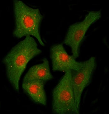 PPIL2 Antibody / Cyp60