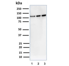 Western blot testing of 1) human A431, 2) human K562 and 3) mouse NIH 3T3 cell lysate with Vinculin 
