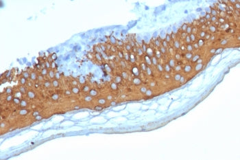 KRT10 Antibody / Cytokeratin 10