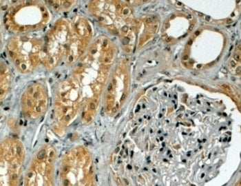 TRIM5 Antibody