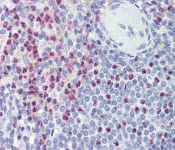 IHC staining of FFPE human spleen tissue with Polycystin 1 antibody. Required HIER: steamed antigen 