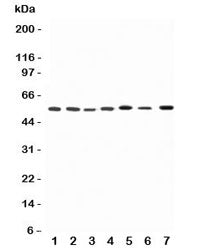 Western blot testing of Kv1.1 antibody and Lane 1: rat brain; 2: (r) testis; 3: (r) heart; 4: human 