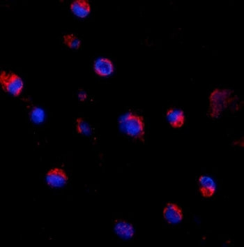 Immunofluorescent staining of FFPE human K562 cells with CD69 antibody (red) and DAPI nuclear stain 