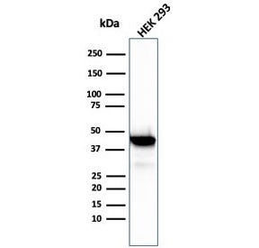 CKB Antibody / Creatine kinase B
